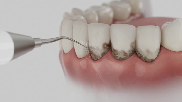 Trusted Root Canal Treatment service in San Fernando, CA - Dentist Open Now